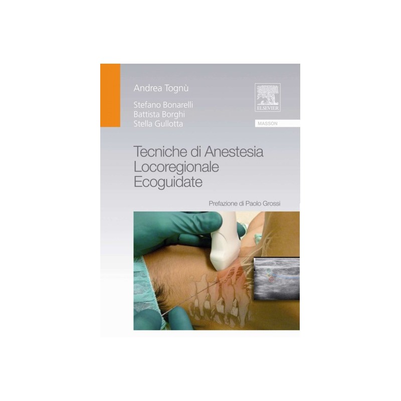 TECNICHE DI ANESTESIA LOCOREGIONALE ECOGUIDATE